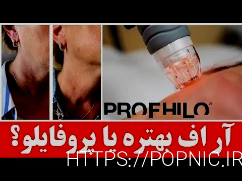 آر اف بهتر است یا هایفو